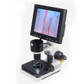 8 Zoll Nailfold Micirculation Microscope Detector